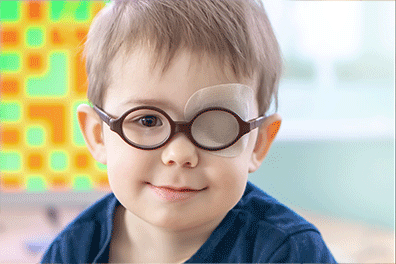 Patching treatment for Amblyopia (lazy eye) - Children's Health